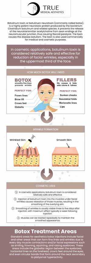 Botox Injection Specialist Near Me in Avon CT