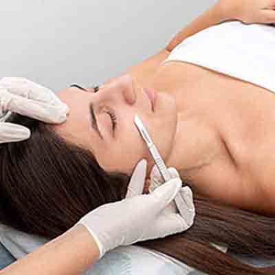 Dermaplaning Near Me in Avon, CT