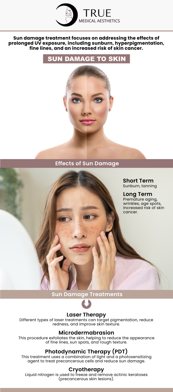 True Medical Aesthetics offers specialized treatments for sun-damaged skin, helping restore your skin’s youthful appearance. Our services, including advanced skincare and rejuvenation therapies, target discoloration, wrinkles, and sunspots, leaving you with smoother, healthier skin. Trust Tristen Durkin, RN to bring back your natural glow. For more information, contact us or request an appointment online. We are conveniently located at 50 Avon Meadow Lane Avon, CT 06001. True Medical Aesthetics offers specialized treatments for sun-damaged skin, helping restore your skin’s youthful appearance. Our services, including advanced skincare and rejuvenation therapies, target discoloration, wrinkles, and sunspots, leaving you with smoother, healthier skin. Trust Tristen Durkin, RN to bring back your natural glow. For more information, contact us or request an appointment online. We are conveniently located at 50 Avon Meadow Lane Avon, CT 06001.