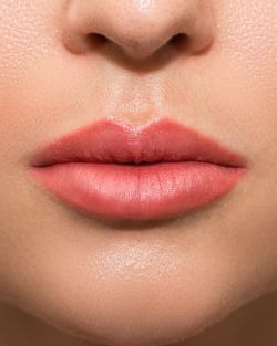 Lip Flip Treatment Near Me in Avon, CT