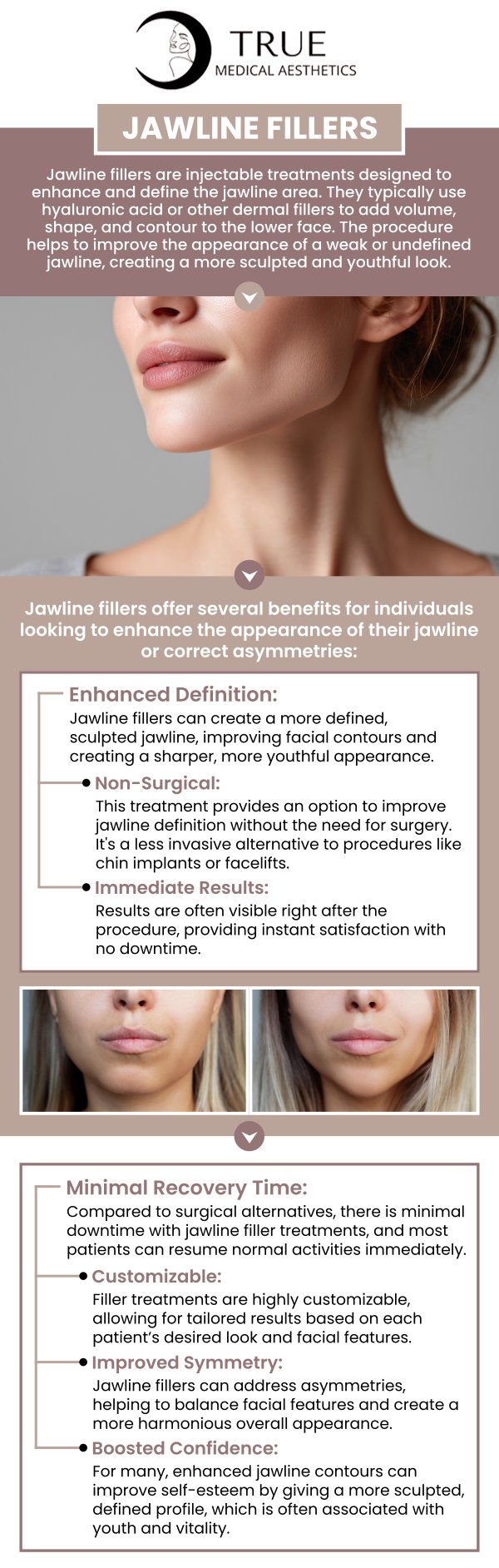 Common questions asked by clients: How long does the result of jawline fillers last? Are jawline fillers safe for everyone? Can jawline fillers help with a double chin? How soon will I see results from jawline fillers? We are conveniently located at 50 Avon Meadow Lane Avon, CT 06001. For more information, contact us or request an appointment online. We serve clients from Avon CT, Simsbury CT, Canton CT, Bloomfield CT, Farmington CT, Burlington CT, and surrounding areas.