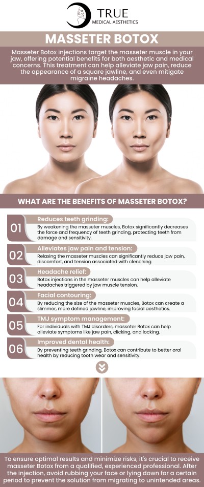 Botox injections for the masseter muscles are a safe and effective way to treat jaw clenching, teeth grinding (bruxism), and TMJ pain. This quick, non-surgical treatment relaxes the muscles, relieving tension and discomfort. As a bonus, it can also create a more slender, V-shaped jawline. For those suffering from jaw pain, teeth grinding, or TMJ symptoms, visit Tristen Durkin, RN and her team for a consultation. For more information, please contact us or schedule an appointment online. We are conveniently located at 50 Avon Meadow Ln, Avon, CT 06001.