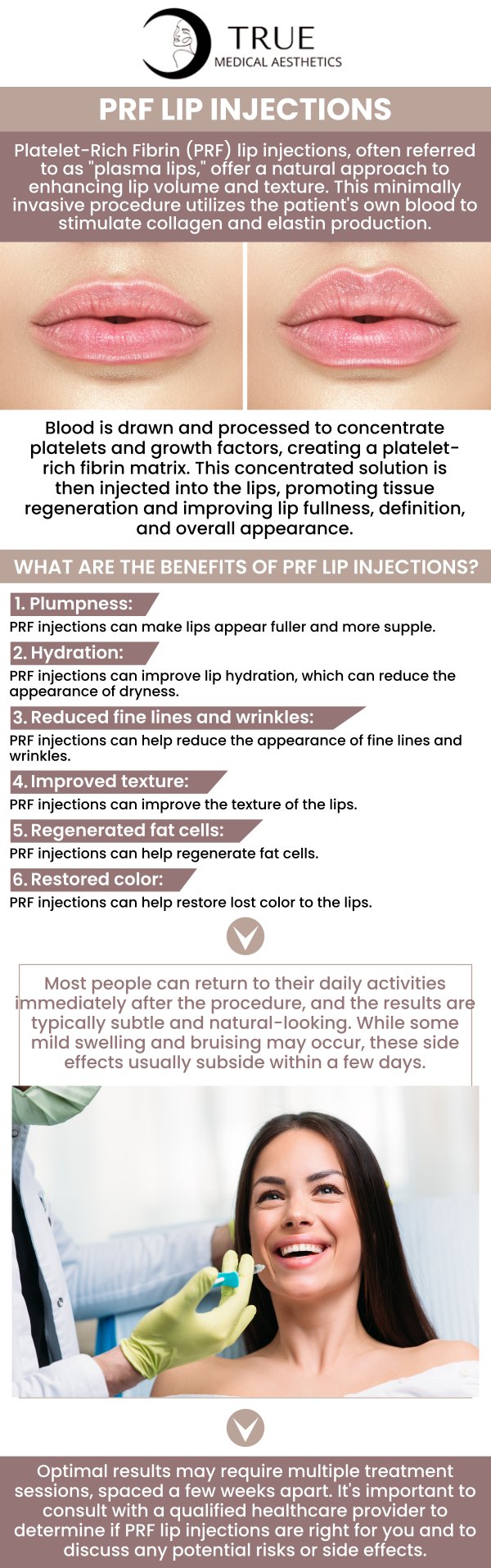 When it comes to our image and self-esteem, our lips are crucial. However, lips become less vibrant and plump as we age. By increasing the lip's moisture, PRF injections improve the lips' overall condition. For more information, contact us or schedule an appointment online. Our clinic is conveniently located at 50 Avon Meadow Lane Avon, CT 06001. We serve clients from Avon CT, Simsbury CT, Canton CT, Bloomfield CT, Farmington CT, Burlington CT, and surrounding areas.