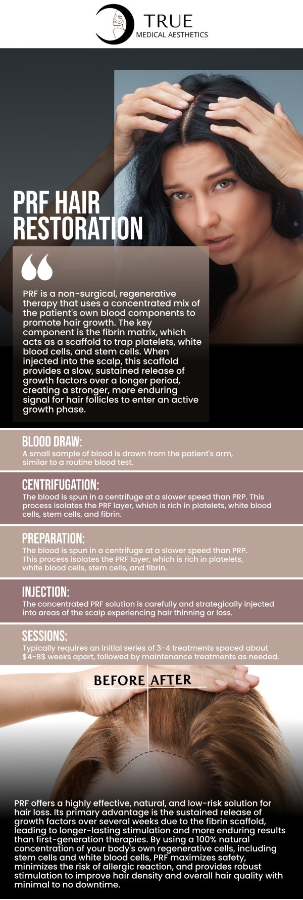 PRF is a non-invasive solution for thinning, balding, receding hairlines, frequent shedding, and various other forms of hair loss. Tristen Durkin, RN, and her dedicated staff at True Medical Aesthetics provide PRF, a secure and efficient therapy for hair loss. It promotes hair development and regrowth by using the client's blood. For more information, please contact us or schedule an appointment online. We are conveniently located at 50 Avon Meadow Ln, Avon, CT 06001.
