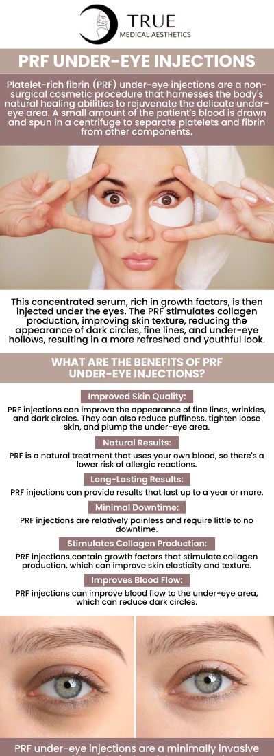 Injecting PRF into the hollows around the eyes helps lessen fine wrinkles and enhance the tone and texture of the skin. PRF injections are offered by Tristen Durkin at True Medical Aesthetics to treat a variety of undereye issues, including dark circles, uneven skin, tear troughs, and more. We are conveniently located at 50 Avon Meadow Lane Avon, CT 06001. For more information, contact us or request an appointment online.