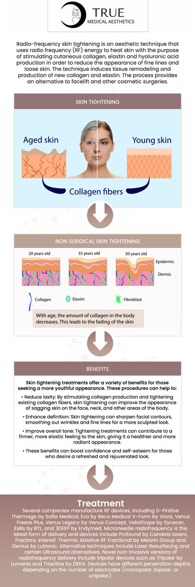 One of the most widely used wrinkle-reduction techniques is BOTOX, which can get rid of age indications and the worn-out appearance you see in the mirror. Tristen Durkin offers Botox injections that can improve your self-esteem and inherent attractiveness. For skin rejuvenation, visit True Medical Aesthetics in Avon, CT. We are conveniently located at 50 Avon Meadow Lane Avon, CT 06001. For more information, contact us or request an appointment online.