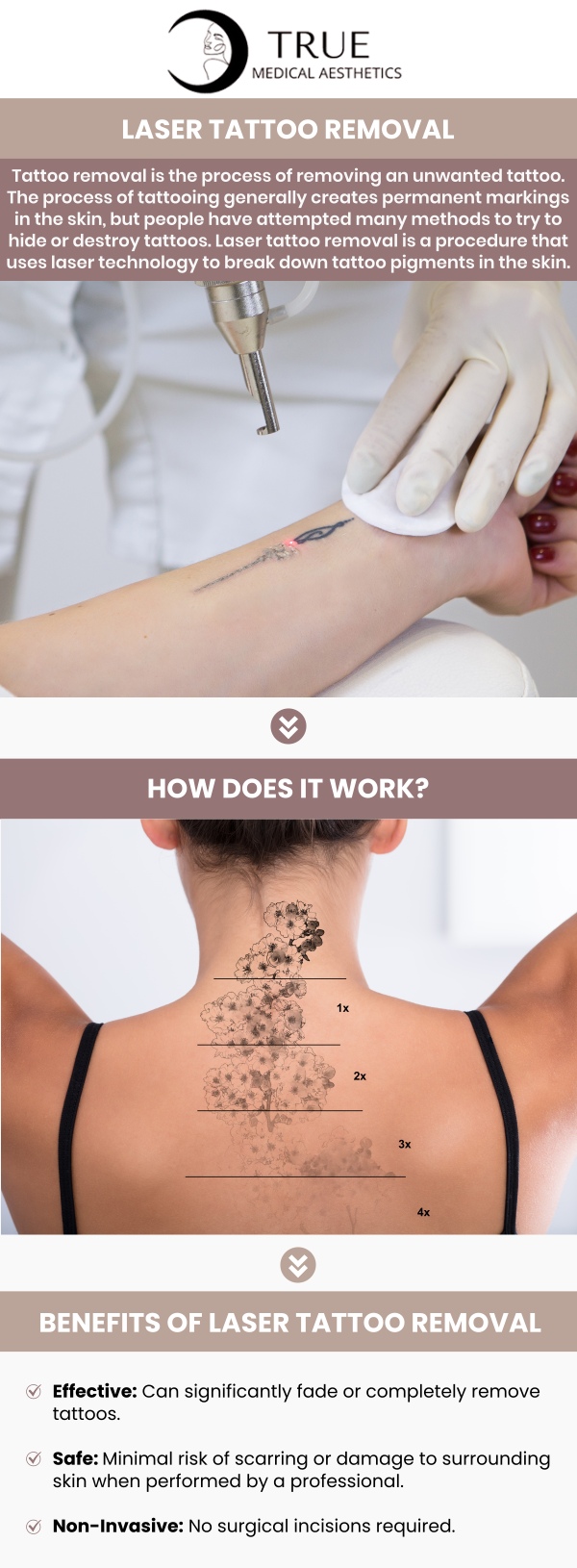 The procedure of removing an unwanted tattoo is referred to as tattoo removal. In most cases, tattooing leaves behind permanent scars on the skin. Permanent ink from tattoos can be removed from the skin using lasers, surgery, or cosmetic procedures. At True Medical Aesthetics, Tristen Durkin, RN, and her team provide laser tattoo removal, a cutting-edge, minimally invasive technique intended to fade and remove undesirable tattoos. For more information, please contact us or schedule an appointment online. We are conveniently located at 50 Avon Meadow Ln Avon, CT 06001. The procedure of removing an unwanted tattoo is referred to as tattoo removal. In most cases, tattooing leaves behind permanent scars on the skin. Permanent ink from tattoos can be removed from the skin using lasers, surgery, or cosmetic procedures. At True Medical Aesthetics, Tristen Durkin, RN, and her team provide laser tattoo removal, a cutting-edge, minimally invasive technique to fade and remove undesirable tattoos. For more information, please contact us or schedule an appointment online. We are conveniently located at 50 Avon Meadow Ln Avon, CT 06001.