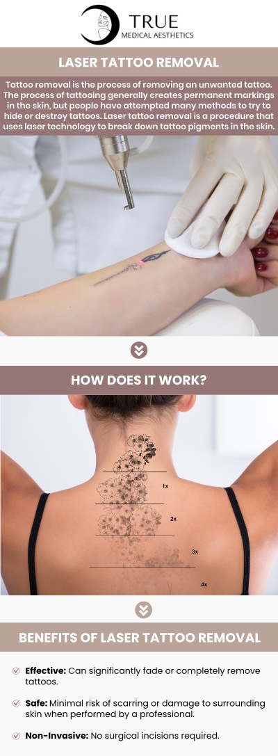 The procedure of removing an unwanted tattoo is referred to as tattoo removal. In most cases, tattooing leaves behind permanent scars on the skin. Permanent ink from tattoos can be removed from the skin using lasers, surgery, or cosmetic procedures. At True Medical Aesthetics, Tristen Durkin, RN, and her team provide laser tattoo removal, a cutting-edge, minimally invasive technique intended to fade and remove undesirable tattoos. For more information, please contact us or schedule an appointment online. We are conveniently located at 50 Avon Meadow Ln Avon, CT 06001. The procedure of removing an unwanted tattoo is referred to as tattoo removal. In most cases, tattooing leaves behind permanent scars on the skin. Permanent ink from tattoos can be removed from the skin using lasers, surgery, or cosmetic procedures. At True Medical Aesthetics, Tristen Durkin, RN, and her team provide laser tattoo removal, a cutting-edge, minimally invasive technique to fade and remove undesirable tattoos. For more information, please contact us or schedule an appointment online. We are conveniently located at 50 Avon Meadow Ln Avon, CT 06001.