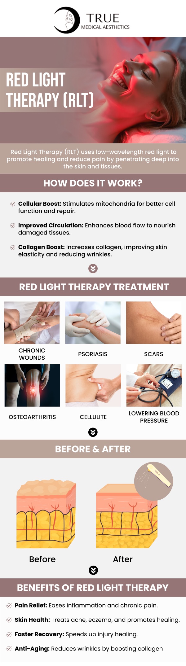 Common questions asked by clients: Can red light therapy help with acne or other skin conditions? How does red light therapy stimulate collagen production and improve skin elasticity? What makes red light therapy different from other light or laser therapies? Is red light therapy effective for anti-aging treatments? For more information, contact us or schedule an appointment online. Our clinic is conveniently located at 50 Avon Meadow Lane Avon, CT 06001. We serve clients from Avon CT, Simsbury CT, Canton CT, Bloomfield CT, Farmington CT, Burlington CT, and surrounding areas. Common questions asked by clients: Can red light therapy help with acne or other skin conditions? How does red light therapy stimulate collagen production and improve skin elasticity? What makes red light therapy different from other light or laser therapies? Is red light therapy effective for anti-aging treatments? For more information, contact us or schedule an appointment online. Our clinic is conveniently located at 50 Avon Meadow Lane Avon, CT 06001. We serve clients from Avon CT, Simsbury CT, Canton CT, Bloomfield CT, Farmington CT, Burlington CT, and surrounding areas.